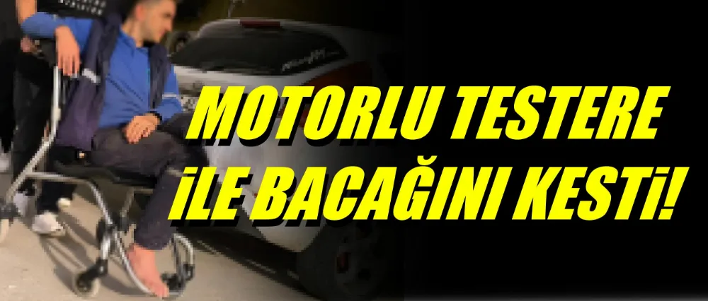 Motorlu testere ile bacağını kesti!