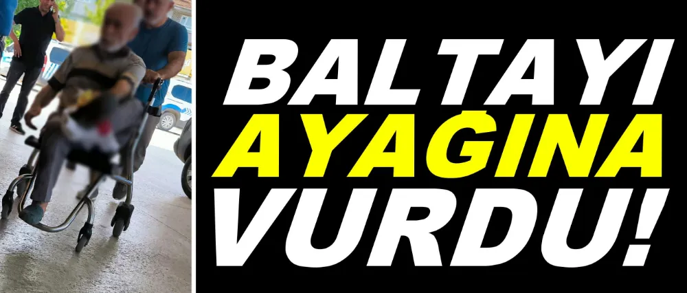 Baltayı ayağına vurdu!