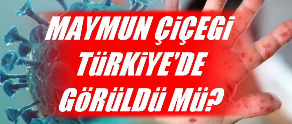 Maymun çiçeği Türkiye