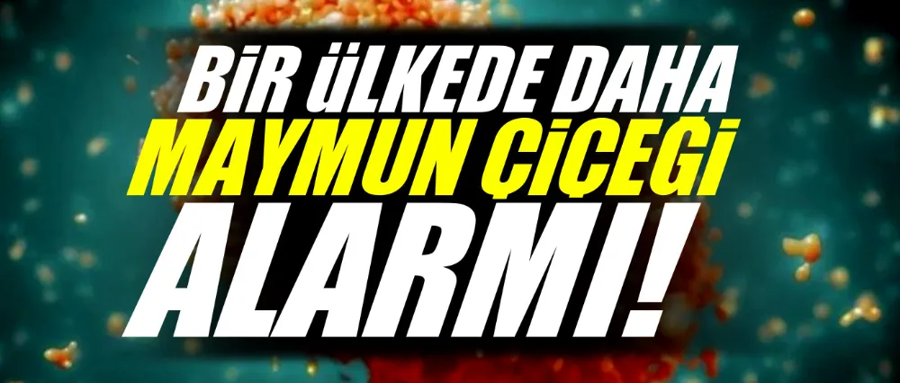 Bir ülkede daha maymun çiçeği alarmı!