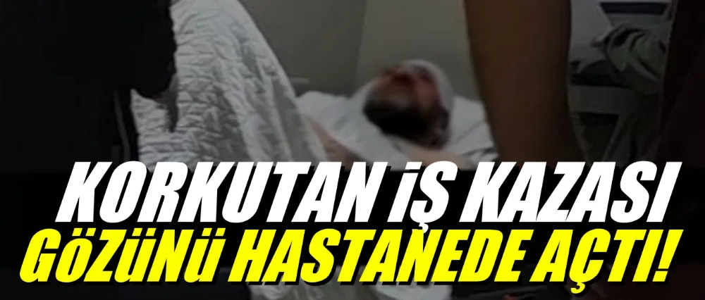 Makinenin motor kısmına kafasını çarptı!