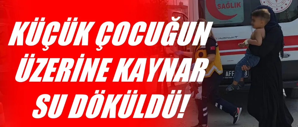 Küçük çocuğun üzerine kaynar su döküldü!