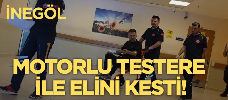 Motorlu testere ile elini kesti!